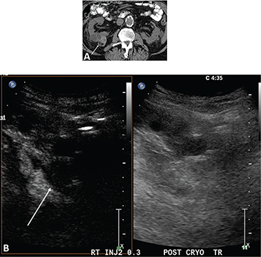 Fig 6